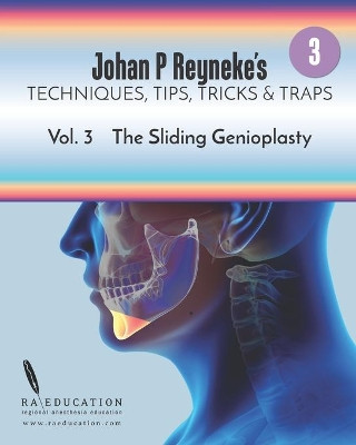 Johan P. Reyneke's Techniques, Tips, Tricks and Traps Vol 3: The Sliding Genioplasty by Johan P Reyneke 9781948083195