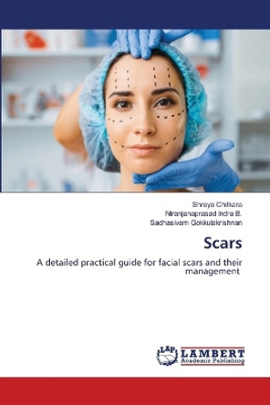 Scars by Shreya Chitkara 9786206141969