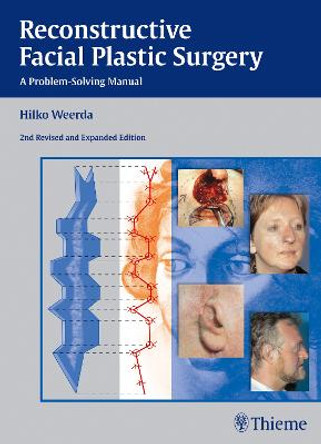 Reconstructive Facial Plastic Surgery: A Problem-Solving Manual by Hilko Weerda