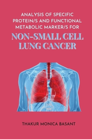 Analysis of Specific Protein S and Functional Metabolic Marker S for Non Small Cell Lung by Thakur Monica Basant 9784013730390