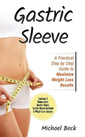 Gastric Sleeve: A Practical Step by Step Guide to Maximize Weight Loss Results (Contains 3 Manuscripts: Gastric Sleeve, Gastric Sleeve Cookbook & Weight Loss Surgery) by Michael Beck 9781986479707