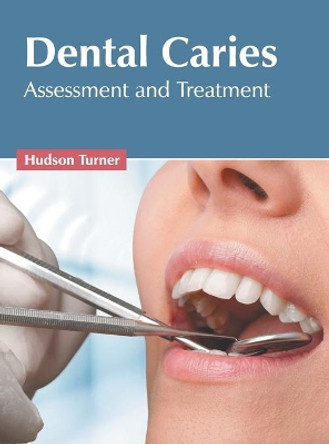 Dental Caries: Assessment and Treatment by Hudson Turner 9781639891481