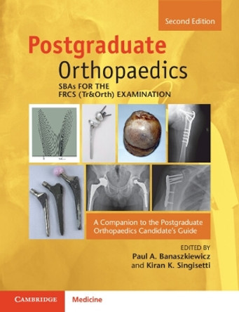 SBAs for the FRCS (Tr&Orth) Examination: A Companion to the Postgraduate Orthopaedics Candidate's Guide Paul A. Banaszkiewicz 9781009287920