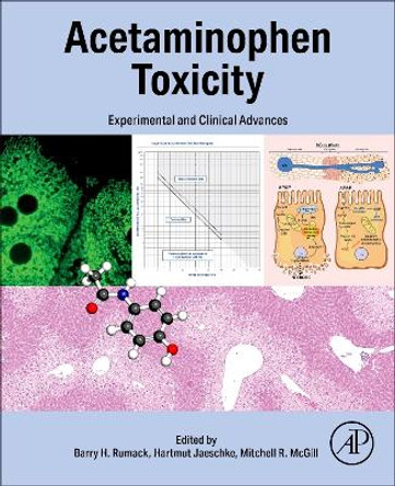 Acetaminophen Toxicity: Experimental and Clinical Advances Barry Rumack 9780443158773