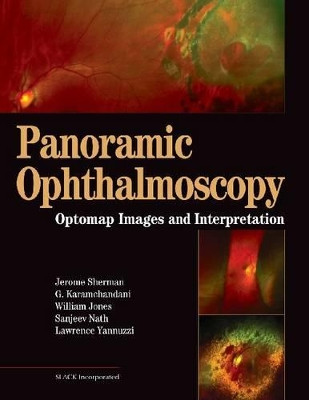 Panoramic Ophthalmoscopy: Optomap Images and Interpretation Jerry Sherman 9781556427800