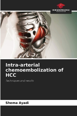 Intra-arterial chemoembolization of HCC by Shema Ayadi 9786206325130