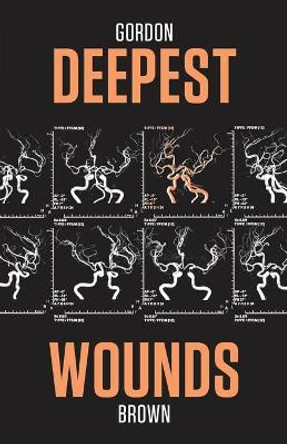 Deepest Wounds by Gordon Brown 9781643960159