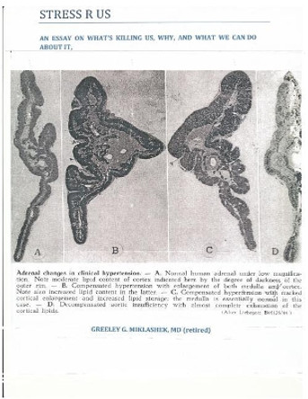 Stress R Us: An Essay On What's Killing Us, Why, and What We Can Do About It by Greeley G Miklashek MD 9781987489866