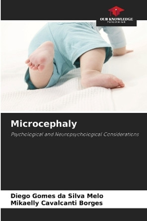 Microcephaly by Diego Gomes Da Silva Melo 9786206460800