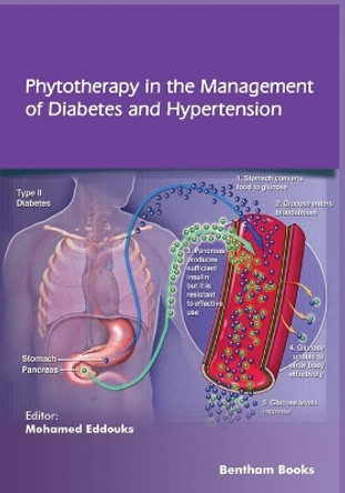 Phytotherapy in the Management of Diabetes and Hypertension - Volume 3 by Mohamed Eddouks 9789811459122