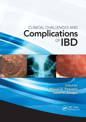 Clinical Challenges and Complications of IBD by Miguel D. Regueiro 9781556429804