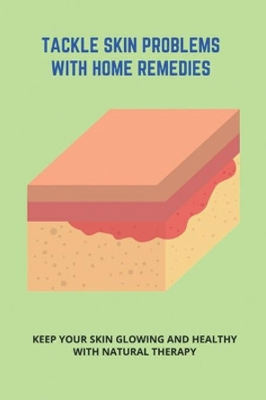 Tackle Skin Problems With Home Remedies: Keep Your Skin Glowing And Healthy With Natural Therapy: How To Get Rid Of Acne In Adults by Jake Quercioli 9798740438788