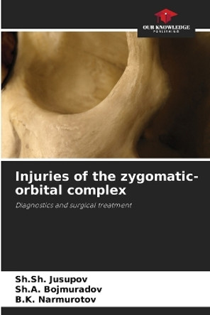 Injuries of the zygomatic-orbital complex by Sh Sh Jusupov 9786205762561