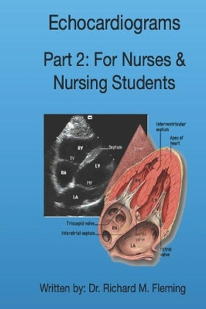 Echocardiograms - Part 2: For Nurses & Nursing Students. by Richard M Fleming 9798569186204