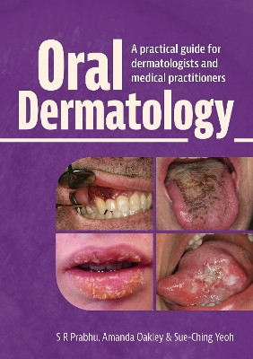 Oral Dermatology: A practical guide for dermatologists and medical practitioners by S.R. Prabhu 9781914961410