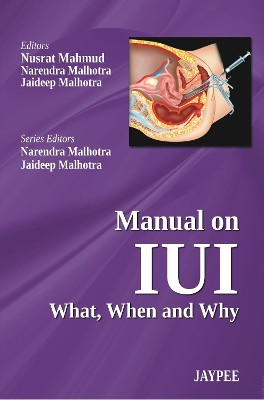 Manual on IUI: What, When and Why by Nusrat Mahmud 9789350904916