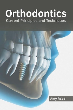 Orthodontics: Current Principles and Techniques by Amy Reed 9781632415721