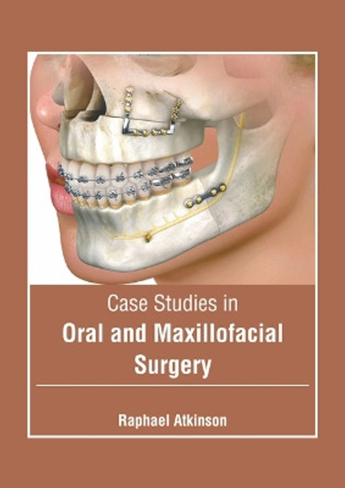 Case Studies in Oral and Maxillofacial Surgery by Raphael Atkinson 9798887406114