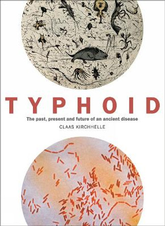Typhoid: The past, present, and future of an ancient disease by Claas Kirchhelle
