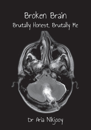 Broken Brain: Brutally Honest, Brutally Me by Aria Nikjooy