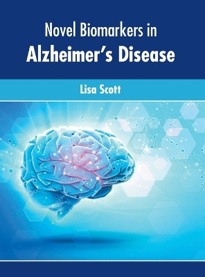 Novel Biomarkers in Alzheimer's Disease by Lisa Scott 9781639874002