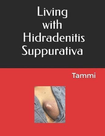 Living with Hidradenitis Suppurativa by Tammi Johnson 9781731272553
