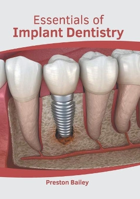 Essentials of Implant Dentistry by Preston Bailey 9781639270538