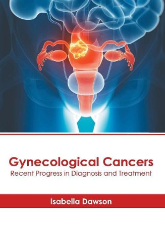 Gynecological Cancers: Recent Progress in Diagnosis and Treatment by Isabella Dawson 9781632416988