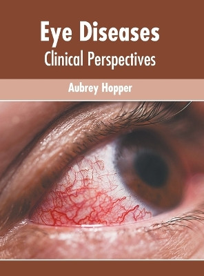 Eye Diseases: Clinical Perspectives by Aubrey Hopper 9781639877935