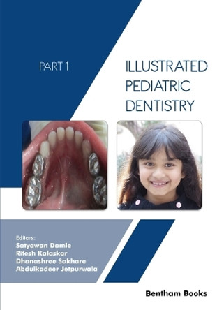 Illustrated Pediatric Dentistry - Part 1 by Ritesh Kalaskar 9789815051506