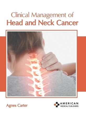 Clinical Management of Head and Neck Cancer by Agnes Carter 9781639279975