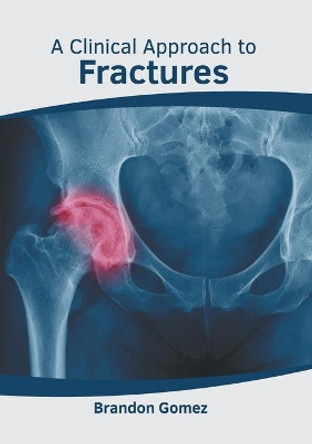 A Clinical Approach to Fractures by Brandon Gomez 9781639273881