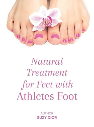 Natural Treatment for Feet with Athletes Foot by Suzy Dior 9781471797002