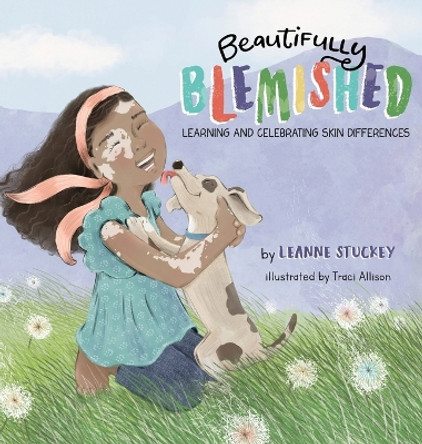 Beautifully Blemished: Learning and Celebrating Skin Differences by Leanne Stuckey 9798985234510 Beautifully Blemished: Learning and Celebrating Skin Differences by Leanne Stuckey 9798985234510