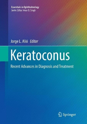 Keratoconus: Recent Advances in Diagnosis and Treatment by Jorge L. Alio 9783319829333