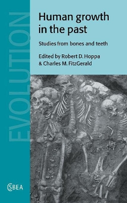 Human Growth in the Past: Studies from Bones and Teeth by Robert D. Hoppa 9780521631532