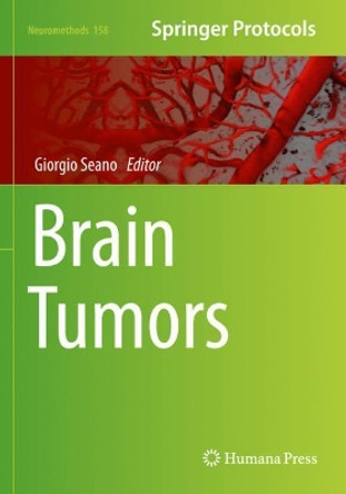 Brain Tumors by Giorgio Seano 9781071608586
