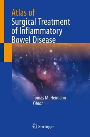 Atlas of Surgical Treatment of Inflammatory Bowel Disease Tomas M. Heimann 9783031624308
