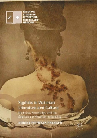 Syphilis in Victorian Literature and Culture: Medicine, Knowledge and the Spectacle of Victorian Invisibility by Monika Pietrzak-Franger 9783319841830
