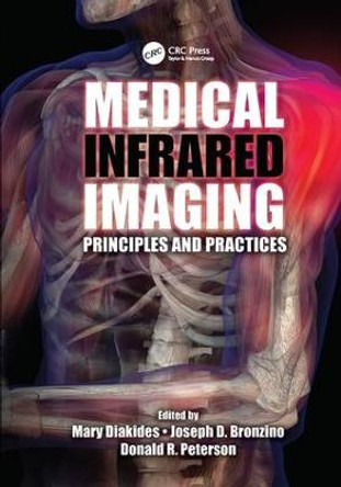 Medical Infrared Imaging: Principles and Practices by Mary Diakides