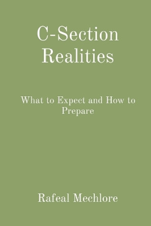 C-Section Realities: What to Expect and How to Prepare by Rafeal Mechlore 9788196811945