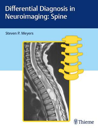 Differential Diagnosis in Neuroimaging: Spine by Steven Meyers