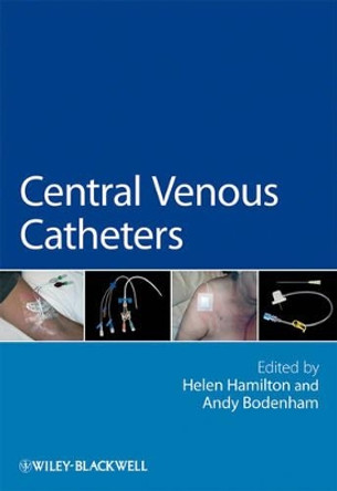 Central Venous Catheters by Helen Hamilton 9780470019948 [USED COPY]