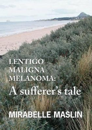 Lentigo Maligna Melanoma: A Sufferer's Tale by Mirabelle Maslin 9780955893698 [USED COPY]