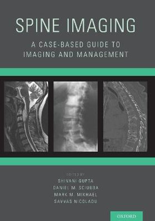 Spine Imaging: A Case-Based Guide to Imaging and Management by Shivani Gupta