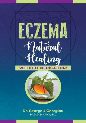 Eczema: Natural Healing, Without Medication by George John Georgiou 9789925569229