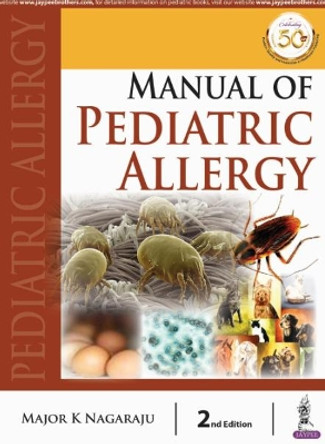 Manual of Pediatric Allergy by Major K Nagaraju 9789389587449