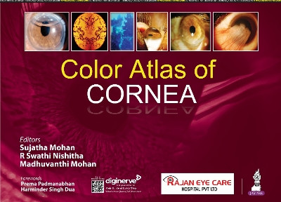 Color Atlas of Cornea by Mohan Sujatha 9789356968981