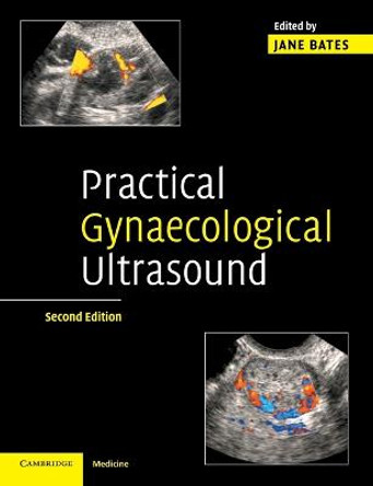 Practical Gynaecological Ultrasound by Jane Bates