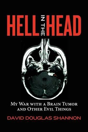 Hell in the Head: My War with a Brain Tumor and Other Evil Things by David Douglas Shannon 9780615642017